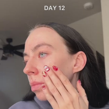 ZENU™ Hypochlorous + Rice Skin Renewal Cream